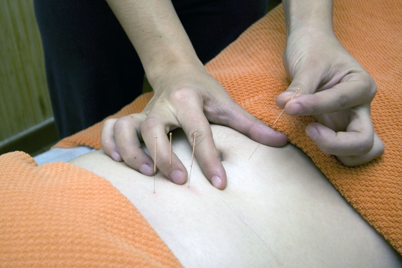 osteopathe-DRAGUIGNAN-min_acupuncture-4175625